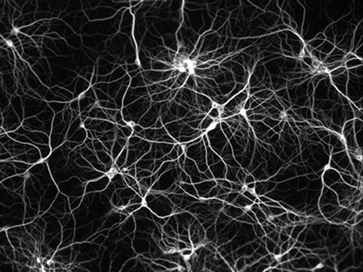  Figure 2 - Figure illustrant le très grand nombre de connexions entre neurones.