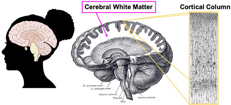 איור 3 - צללית של ילדה עם תמונה של מוח אנושי שמוצבת מעליה, כדי להמחיש מבט אחר על המוח האנושי.