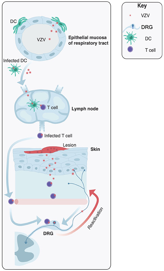 Varicella zoster virus igg. Вирус варицеола зомтер патогенез.