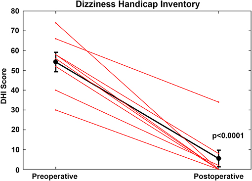 Frontiers Audiovestibular Quantification in Rare Third Window