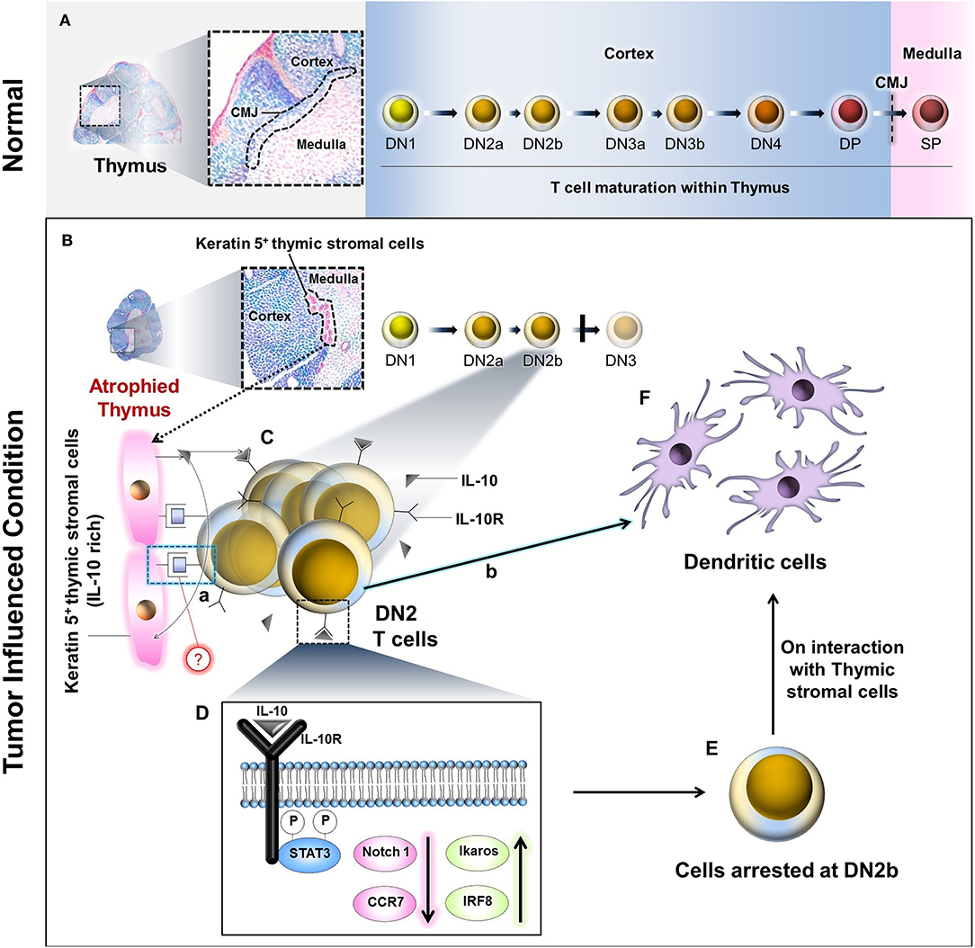 Frontiers Tumor Arrests Dn2 To Dn3 Pro T Cell Transition And Promotes 