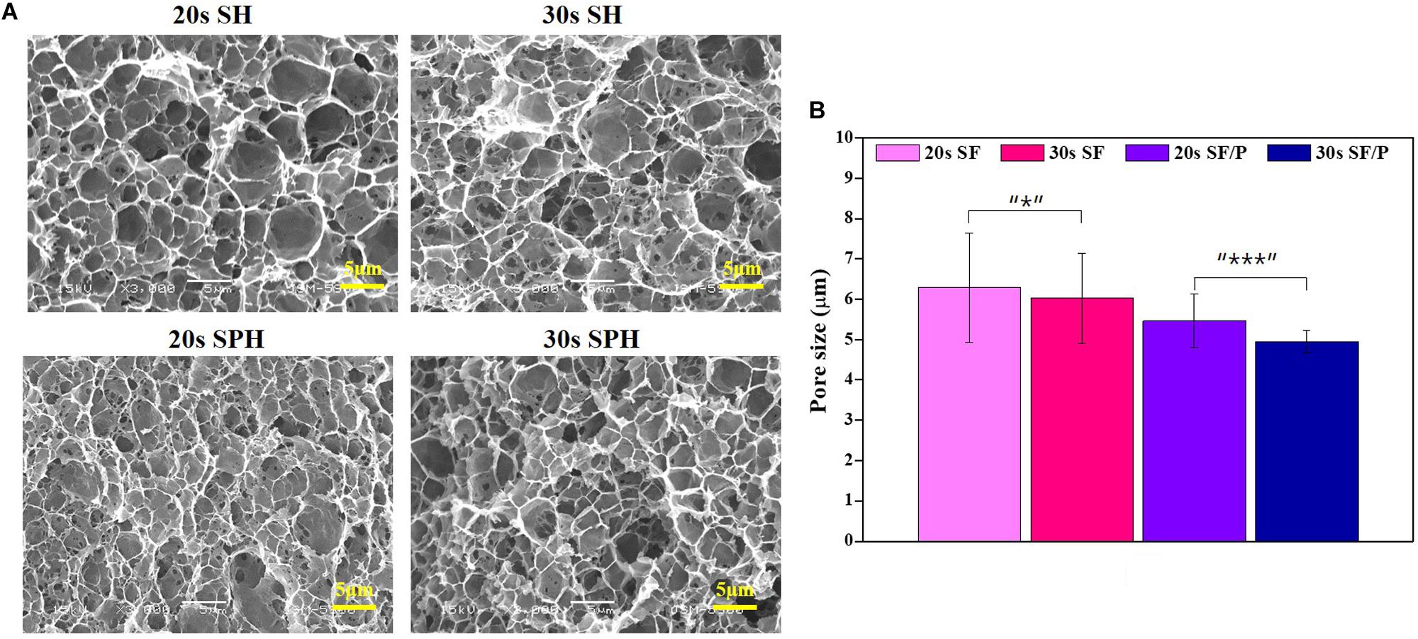 Silk fibroin scaffolds for common cartilage injuries