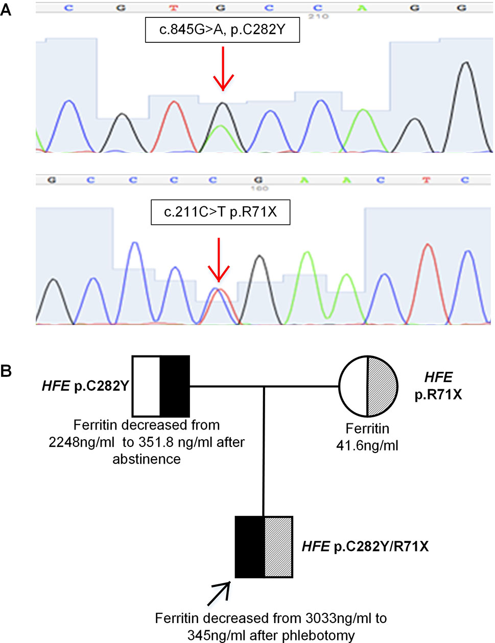 hemochromatosis gene