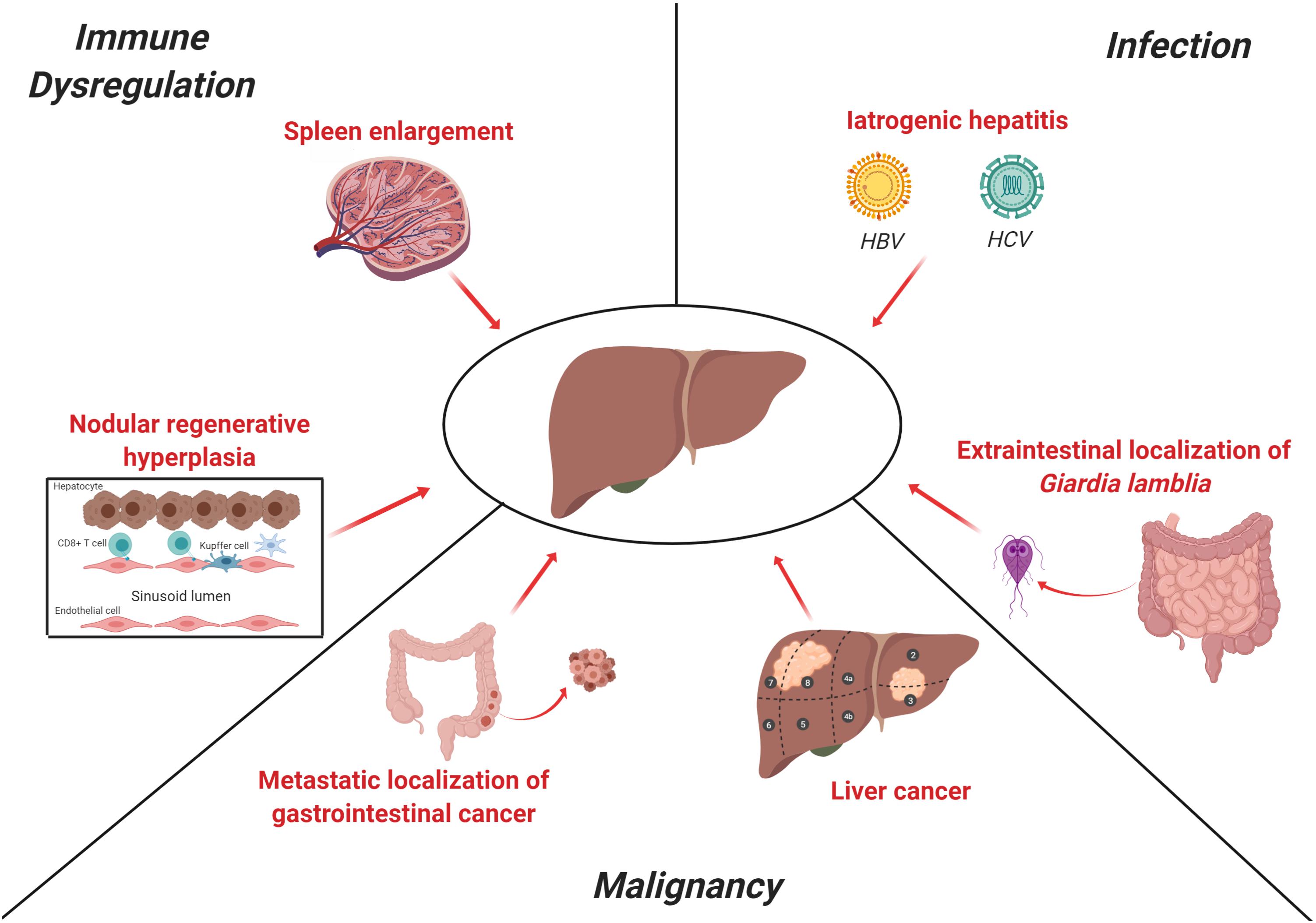 giardiasis hepatitis