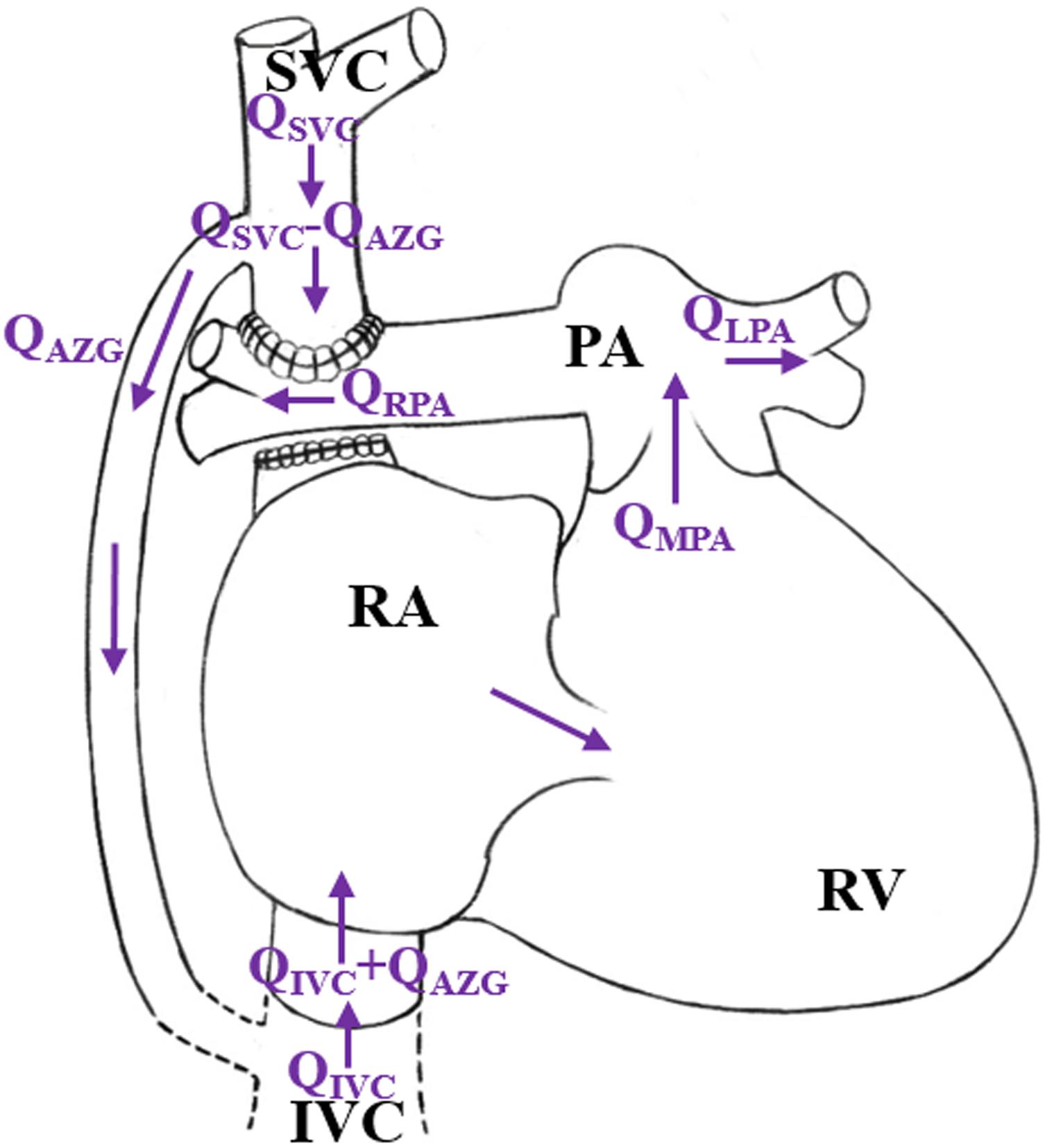 Braz J Cardiovasc Surg - The pulmonary vascular blood supply in