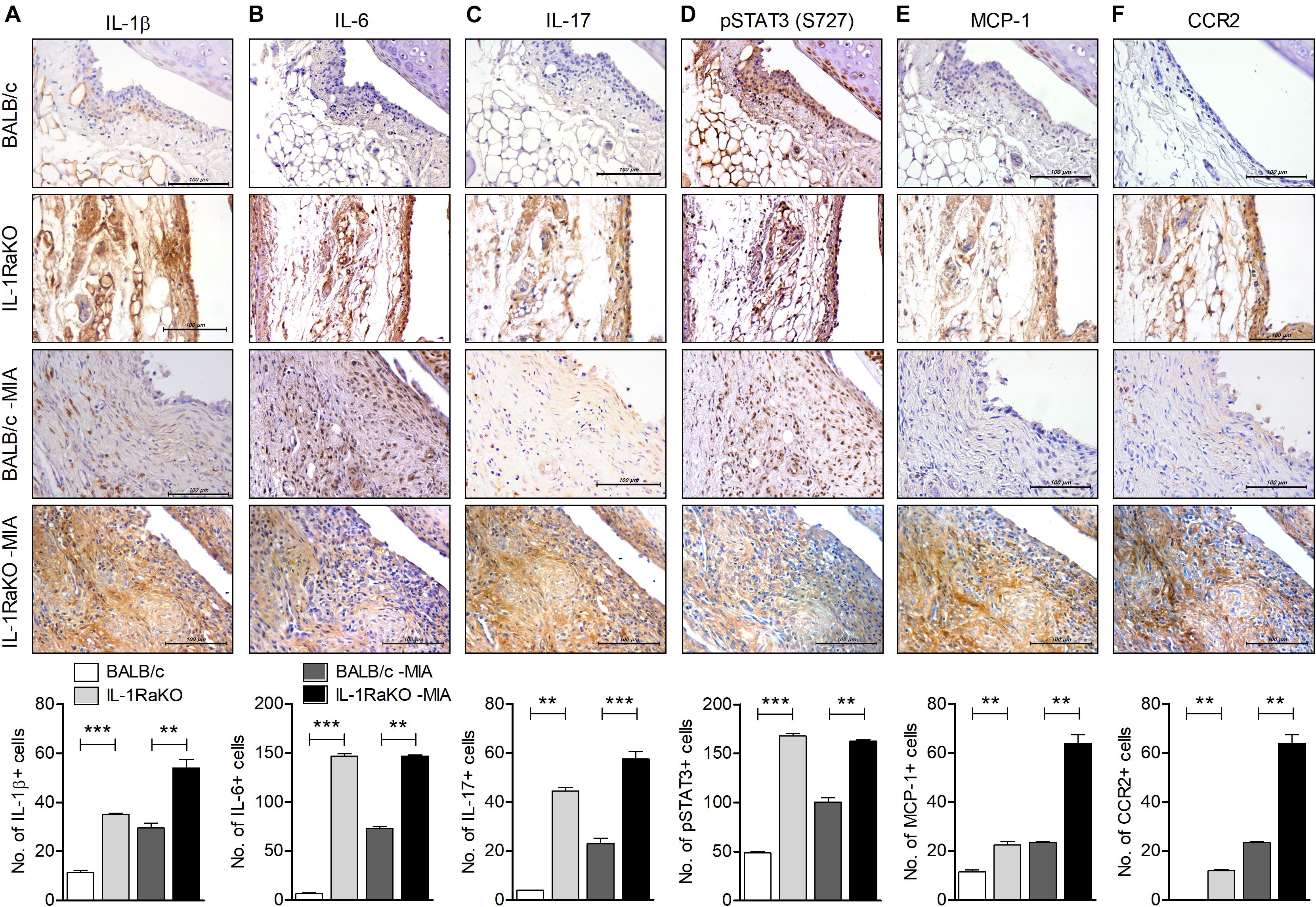Interleukin-1-Interleukin-17 Signaling Axis Induces Cartilage Destruction and Promotes Experimental Osteoarthritis