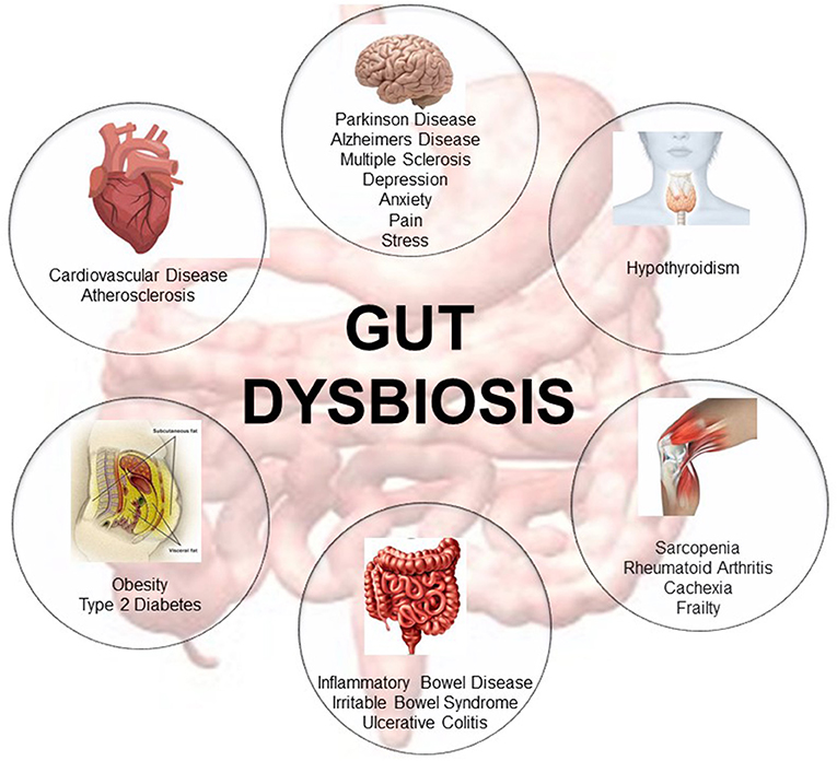 Dysbiosis gyógynövények, Gyógynövények bél dysbiosissal