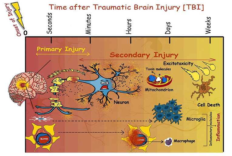 איור 2 - אירועים שמתרחשים בעקבות TBI.