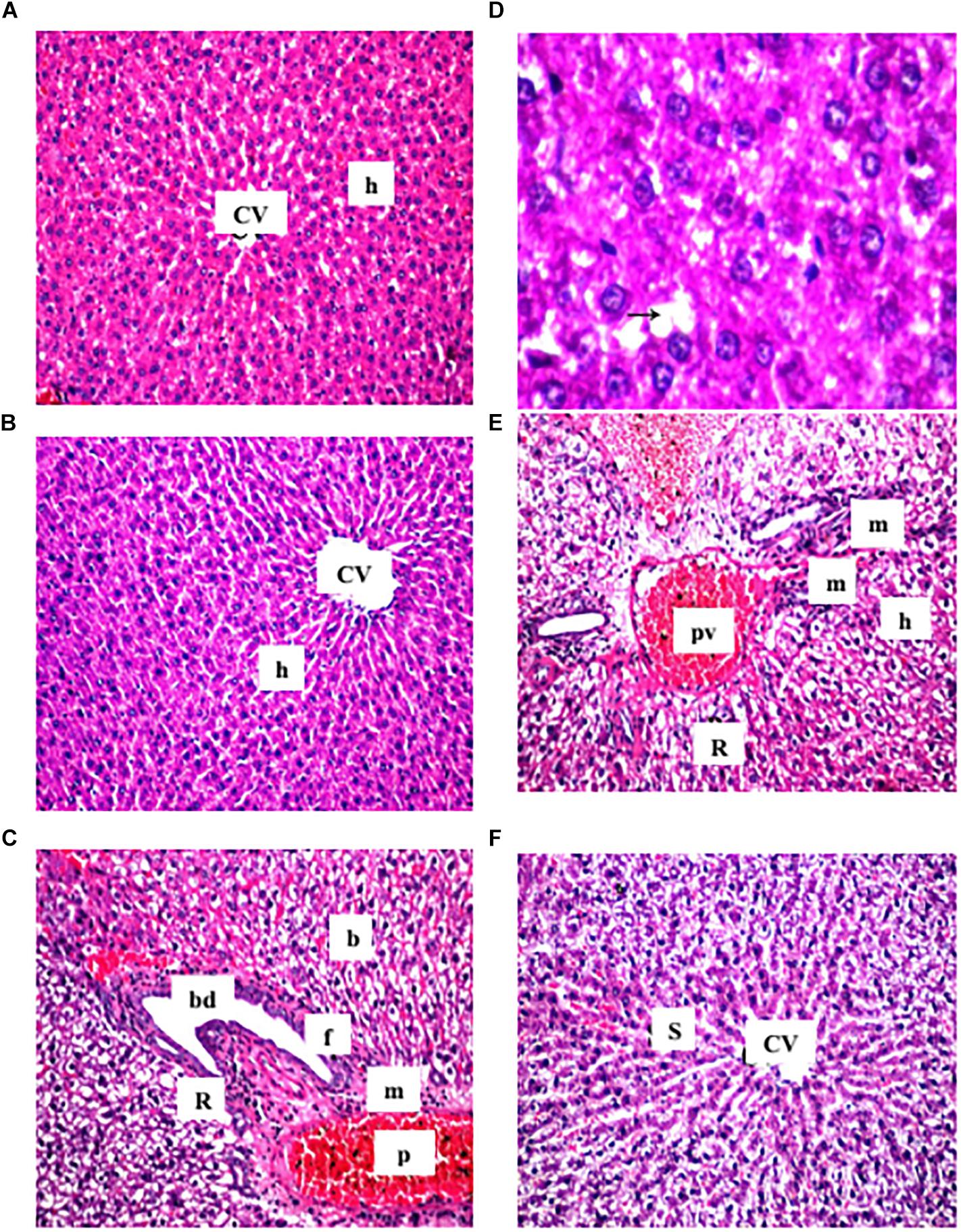 Cranberry juice liver online