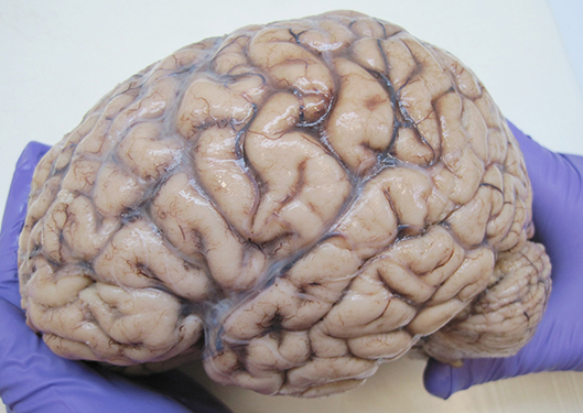 Figure 1 - The human brain contains >85 billion neurons that, together, give rise to nearly everything we do as humans—thinking, seeing, smelling, moving, sleeping, even breathing.