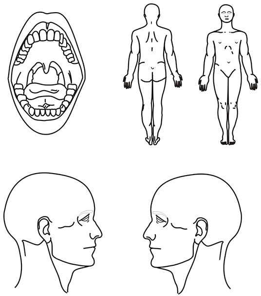 Frontiers  A Pilot Study Evaluating the Prevalence of Cervical