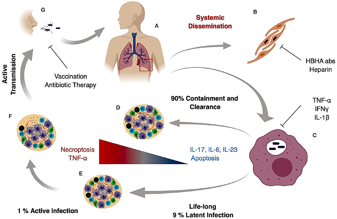 Human disease. Иммунохроматографическая идентификация комплекса m. tuberculosis. Патоген. Tuberculosis gestation Epidemiology.