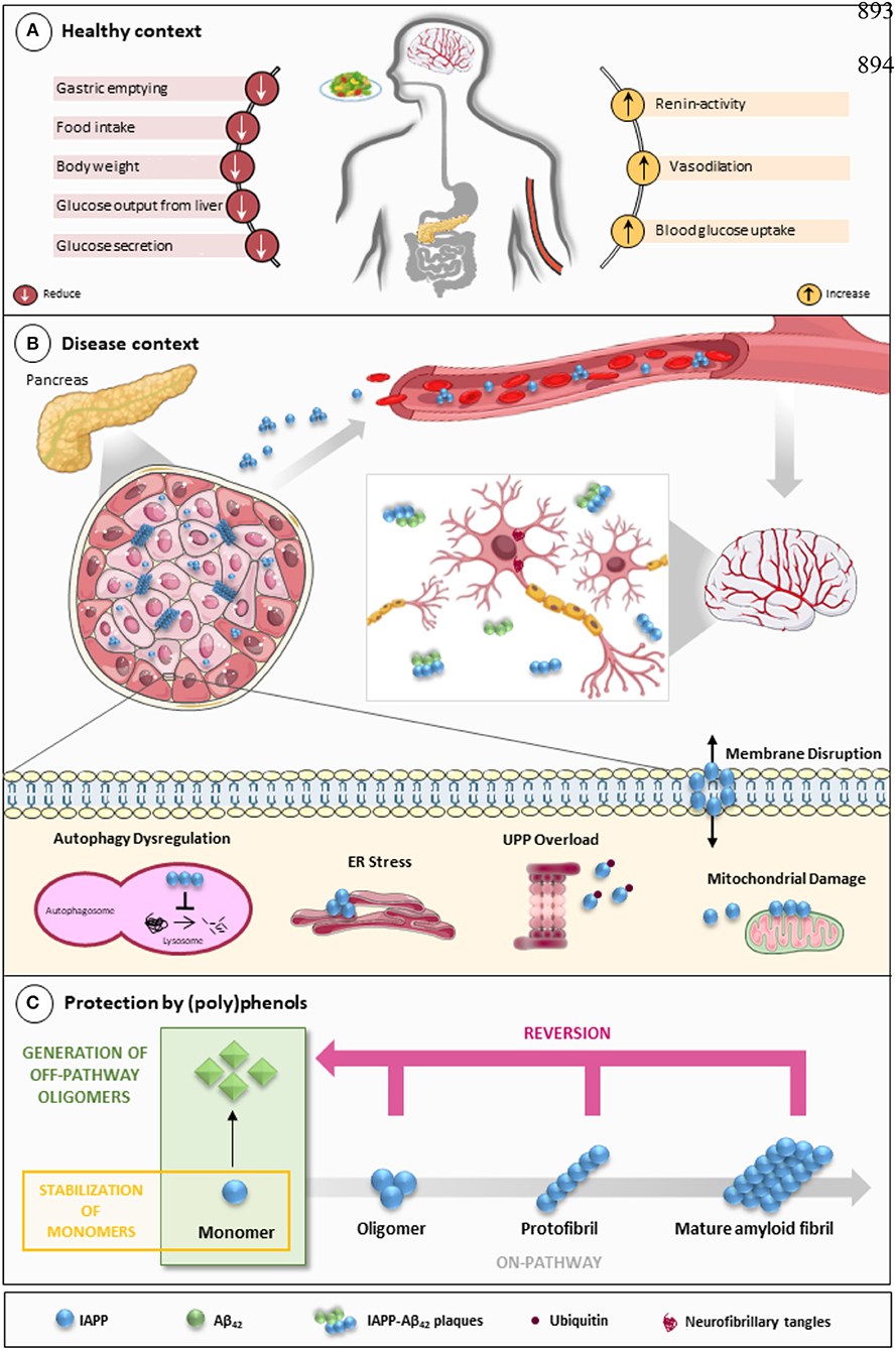 Frontiers Islet Amyloid Polypeptide A Partner In Crime With Ab In The Pathology Of Alzheimer S Disease Molecular Neuroscience