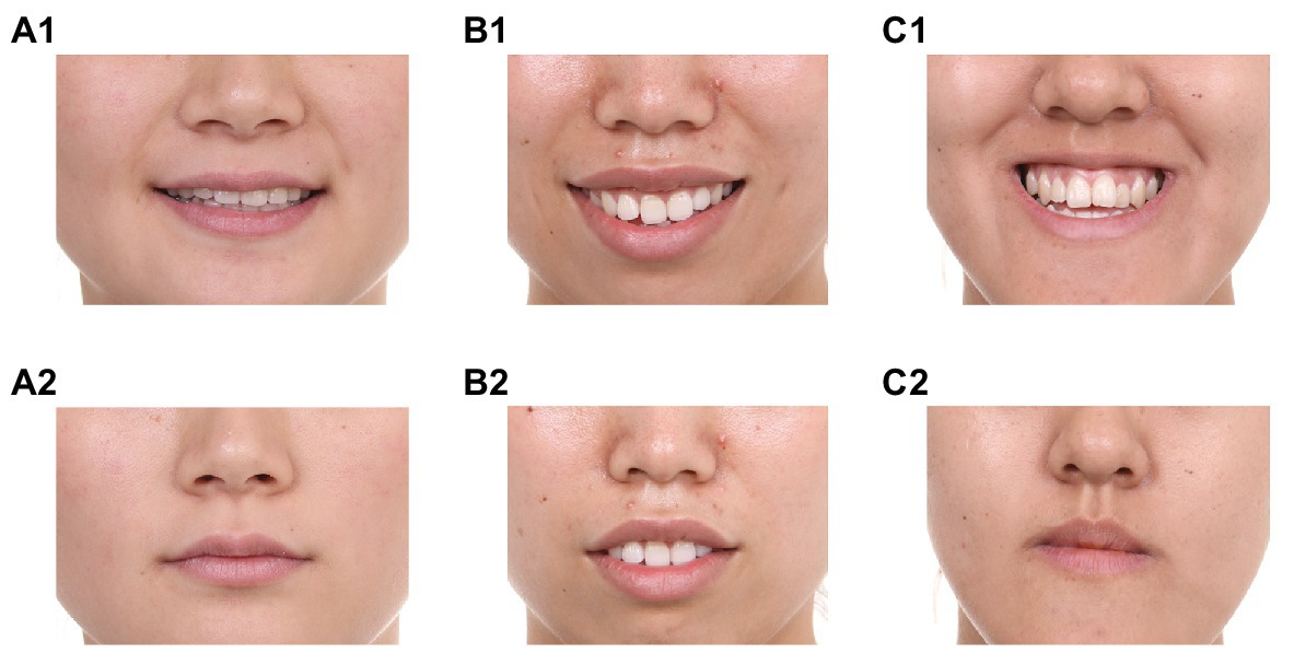 Comparison of Two Scales For Evaluation of Smile and Dental Attractiveness, PDF, Orthodontics