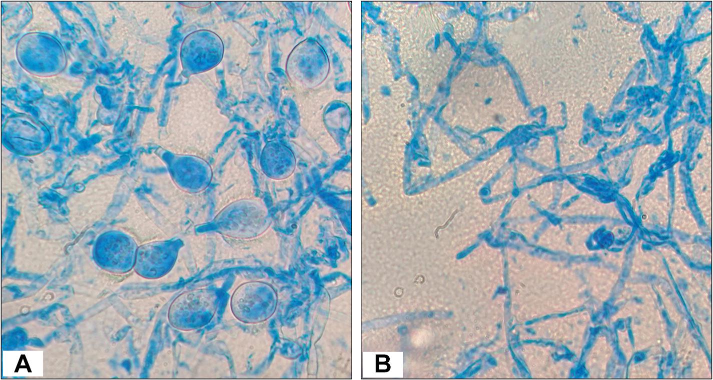 Frontiers | Phylogenetic and Functional Characterization of Culturable ...