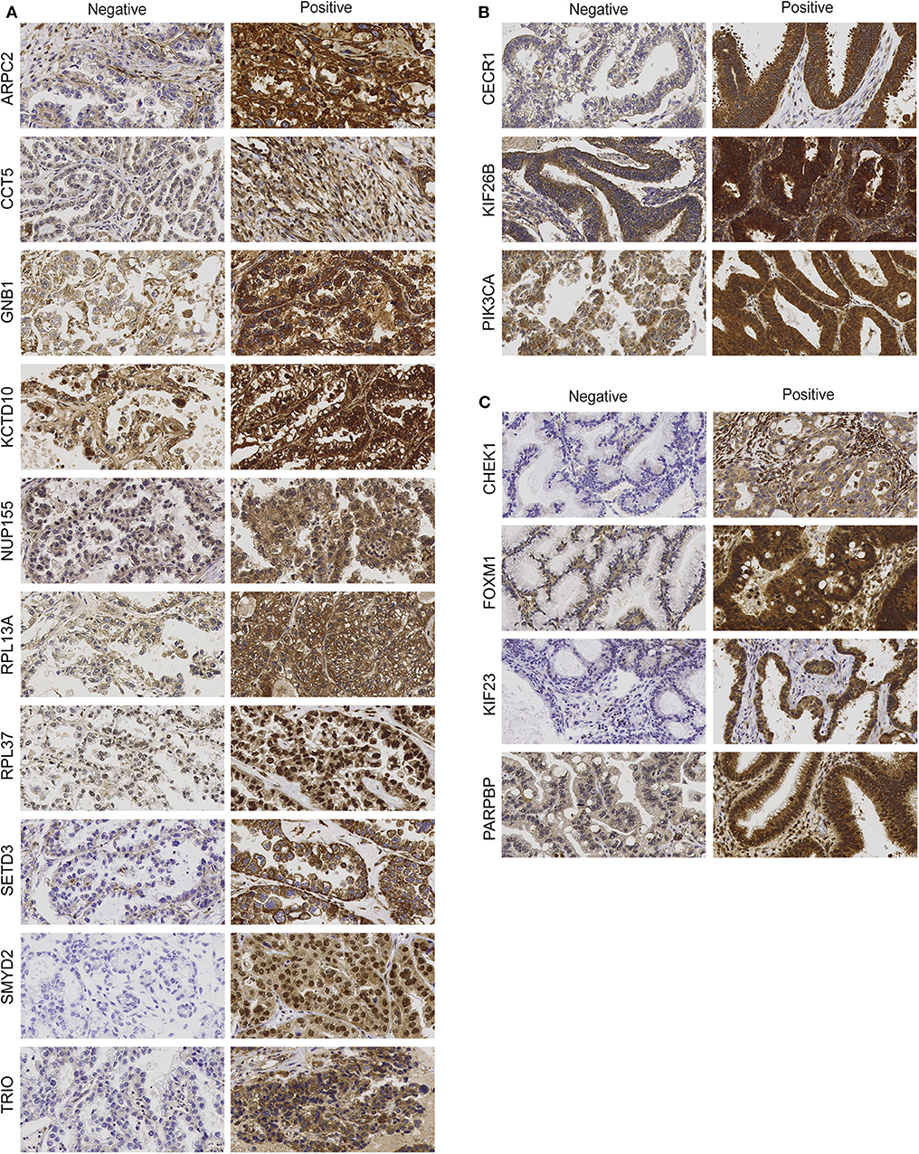 mesothelioma uk trials