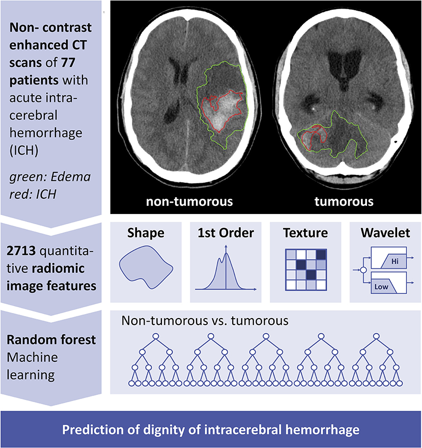 Frontiers | Neoplastic and Non-neoplastic Acute Intracerebral ...