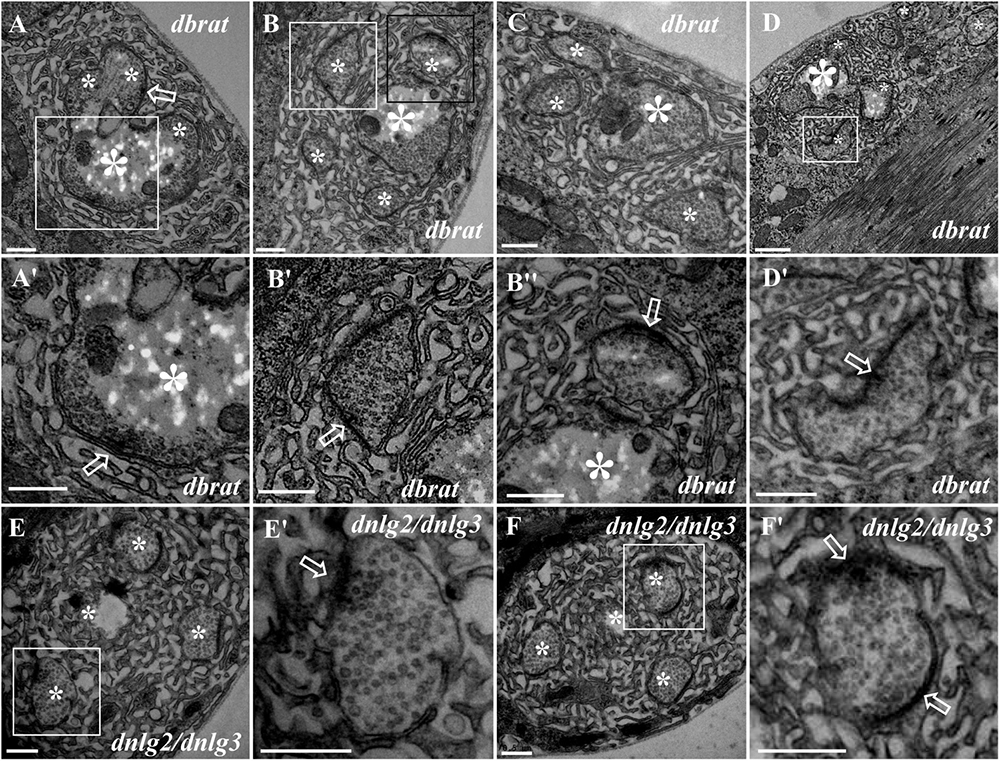 Frontiers | Neurexin and Neuroligins Maintain the Balance of Ghost and ...