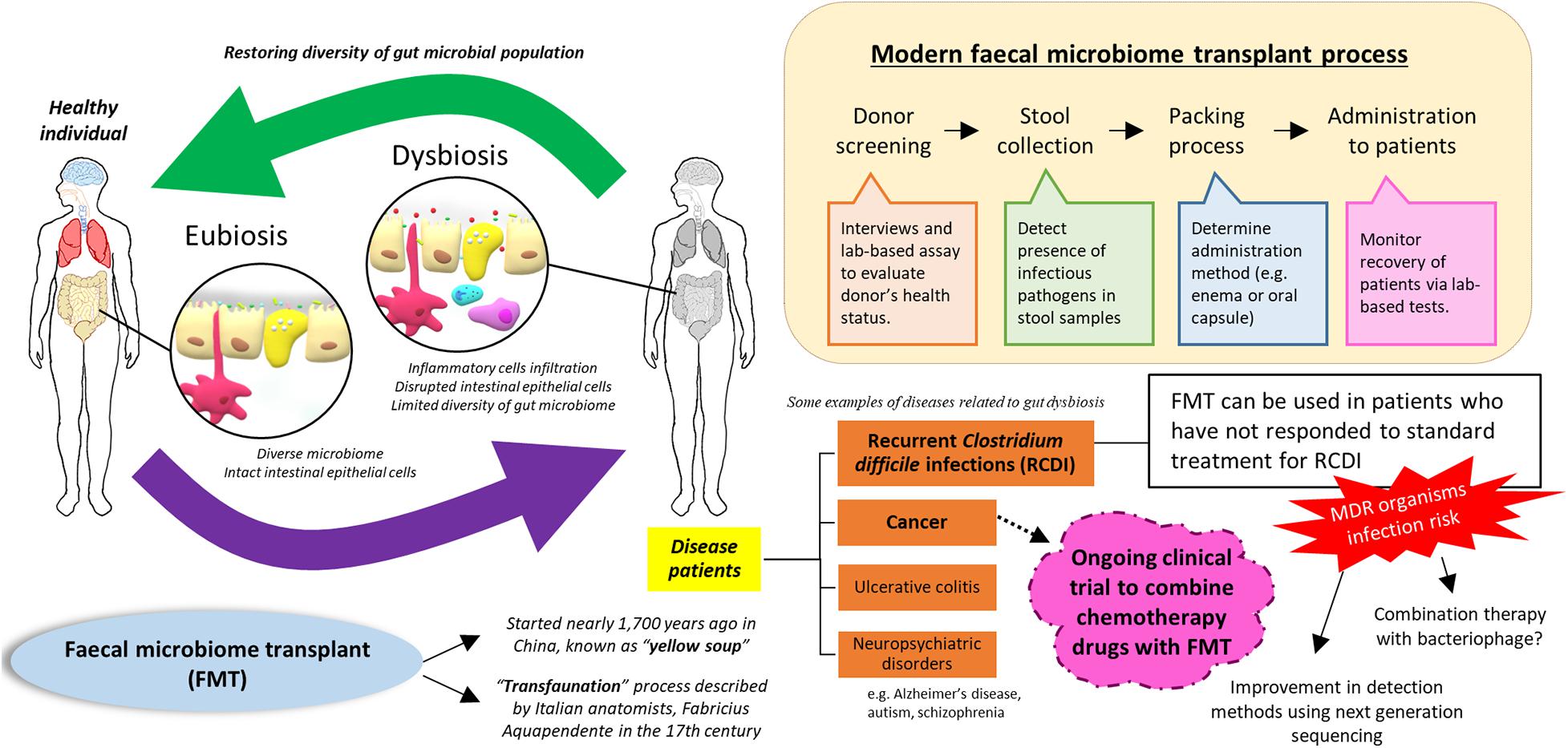 To Get To The Bottom Of Your Microbiome, Start With A Swab Of Poo, NPR  Article