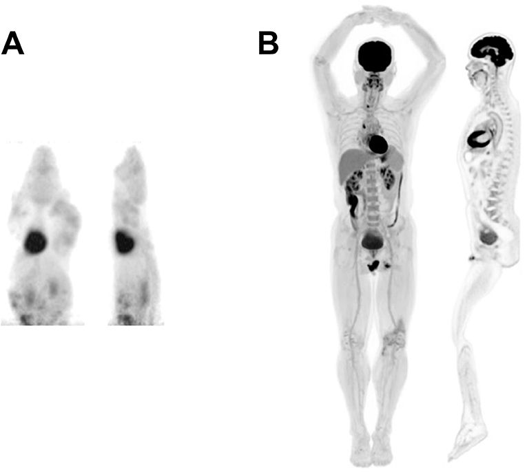 This total body scanner shows 3D images of the whole body