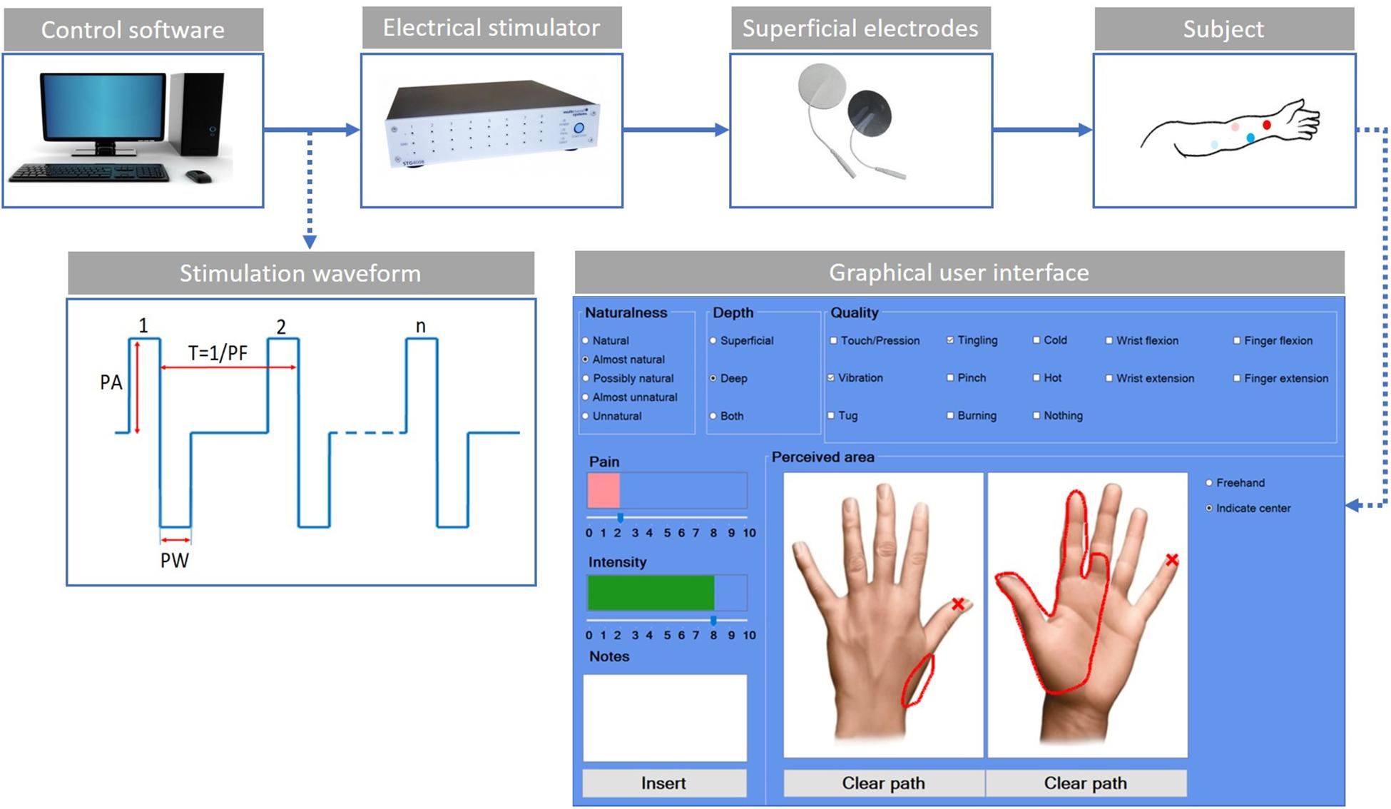 10 Facts About TENS (Transcutaneous Electrical Nerve Stimulation