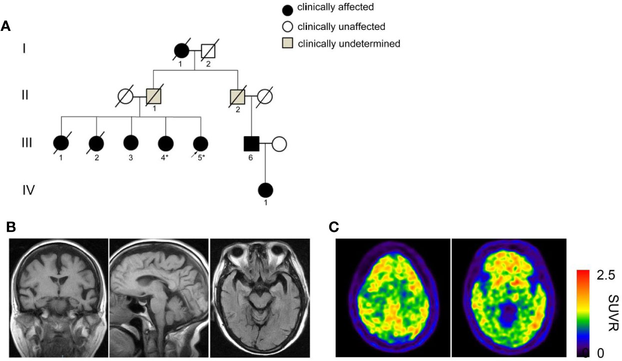 In Autosomal Dominant Inheritance Jsp Fid