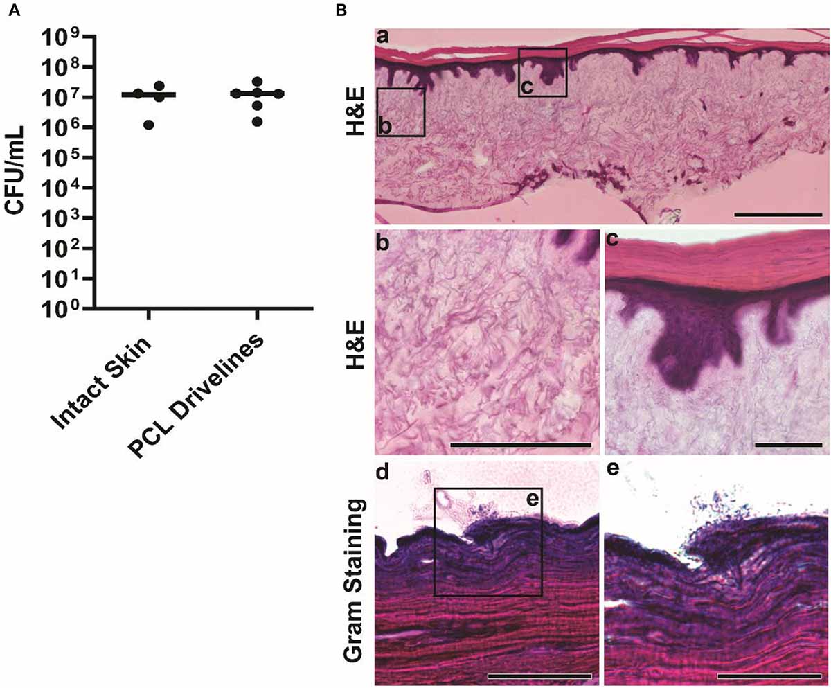 Human skin reconstitution in the cell-sorted skin equivalent (CeSSE)