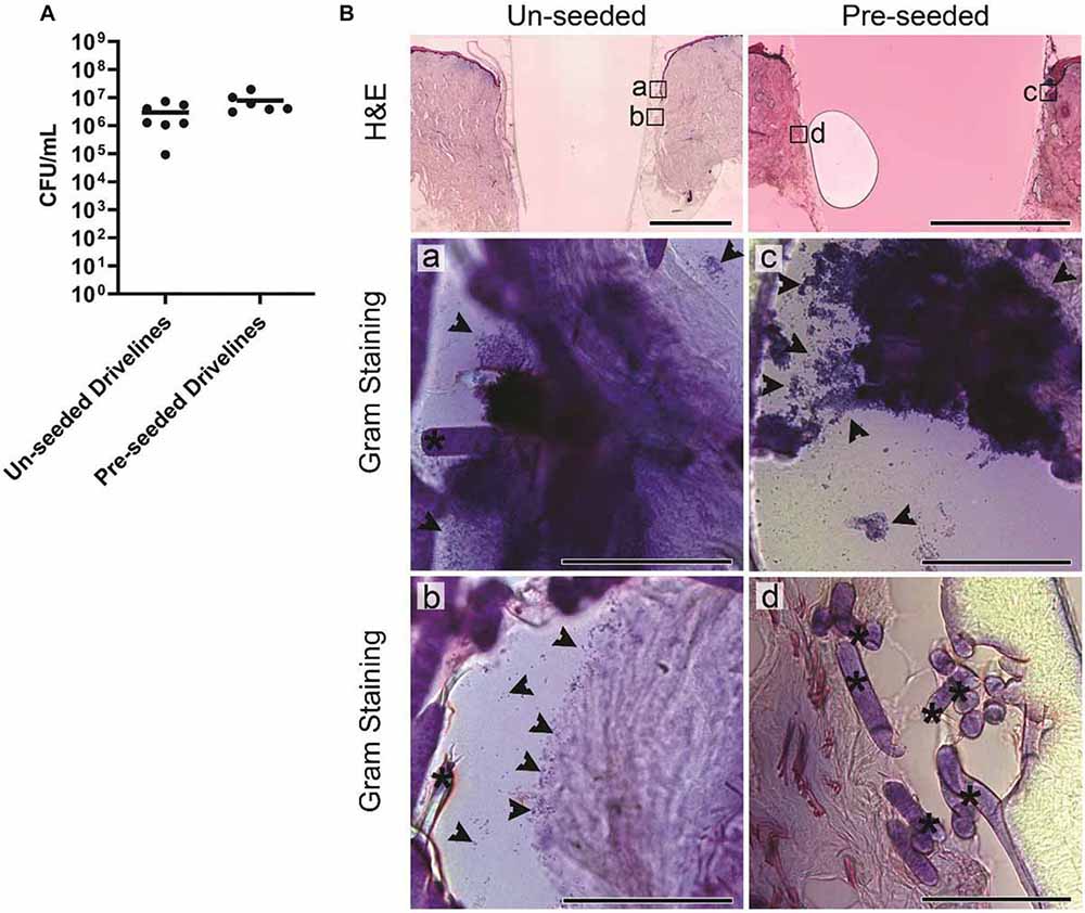 Human skin reconstitution in the cell-sorted skin equivalent (CeSSE)