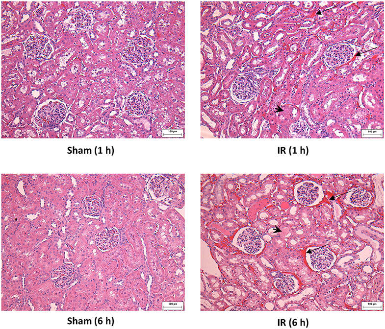 Frontiers | Kidney Ischemia-Reperfusion Elicits Acute Liver Injury and Inflammatory Response ...