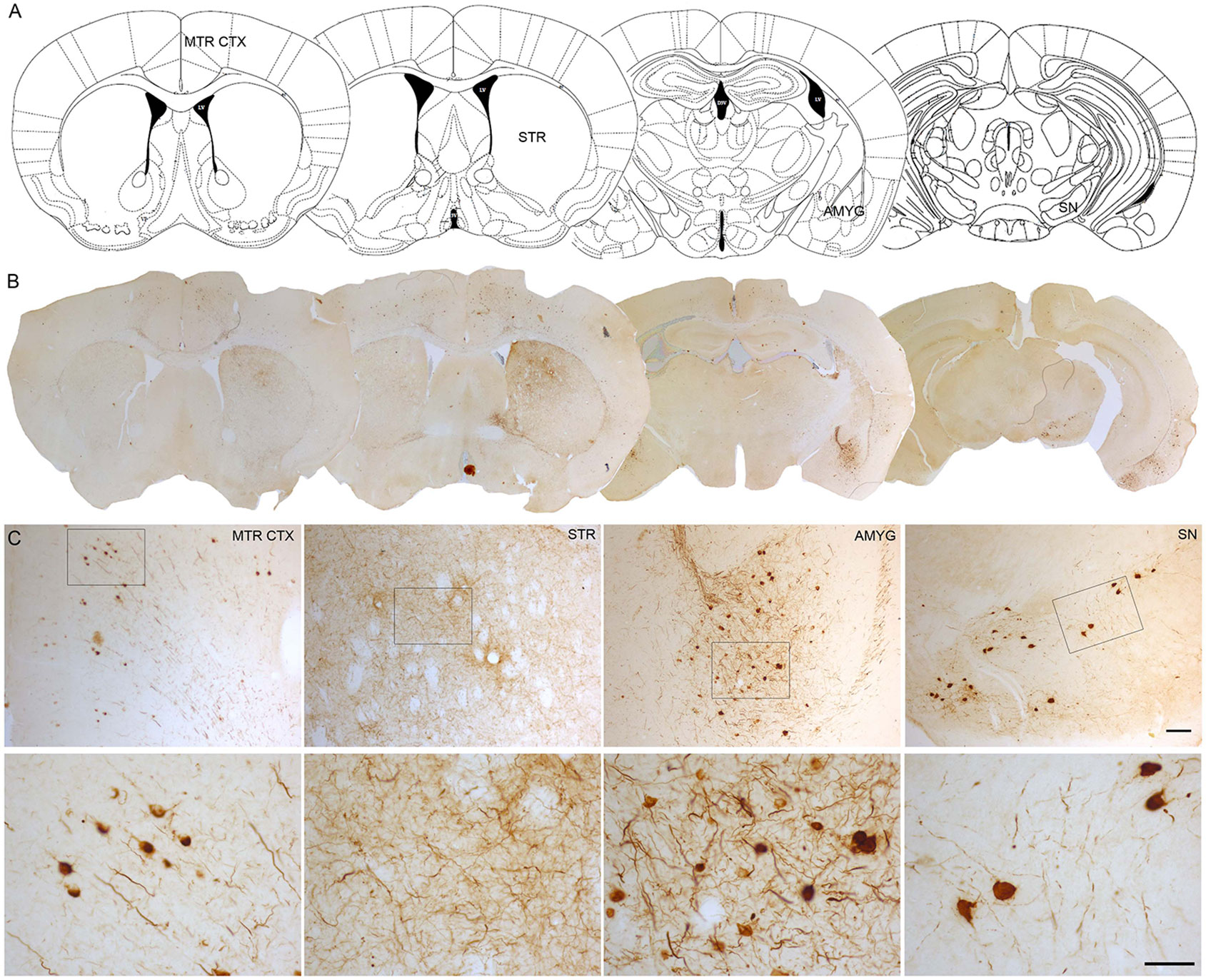 α-Synuclein Aggregation in Treatment of Parkinson's Disease