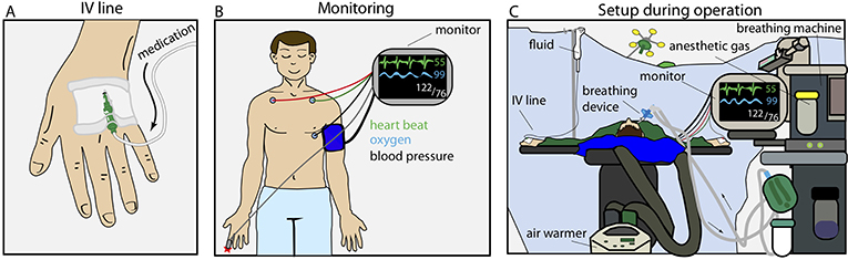 Figure 1 - Setup and monitoring during an operation.
