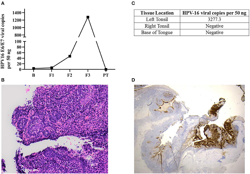 hpv virus with saliva