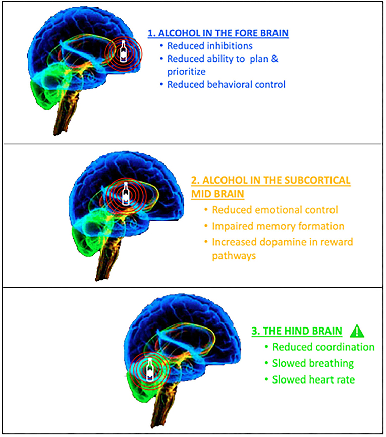 what part of the brain does abilify affect