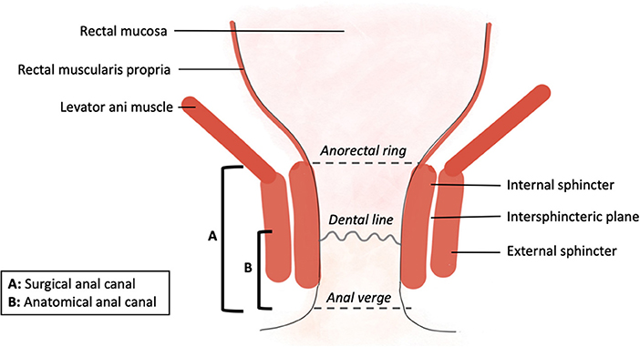 Frontiers Ultimate Functional Preservation With Intersphincteric 