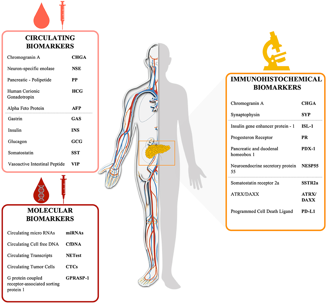 Frontiers Biomarkers For Pancreatic Neuroendocrine Neoplasms Pannens Management An Updated Review Oncology