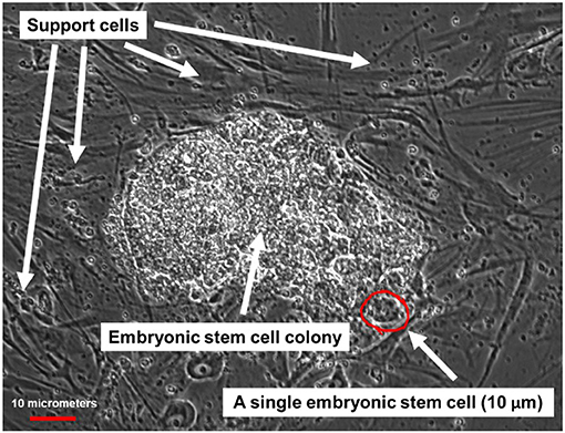 איור 2 - תמונה מבעד מיקרוסקופ של תאי גזע עובריים אנושיים.