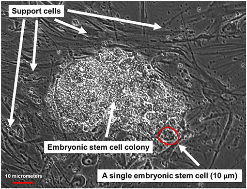 Figure 2 - Microscope image of human ESCs.