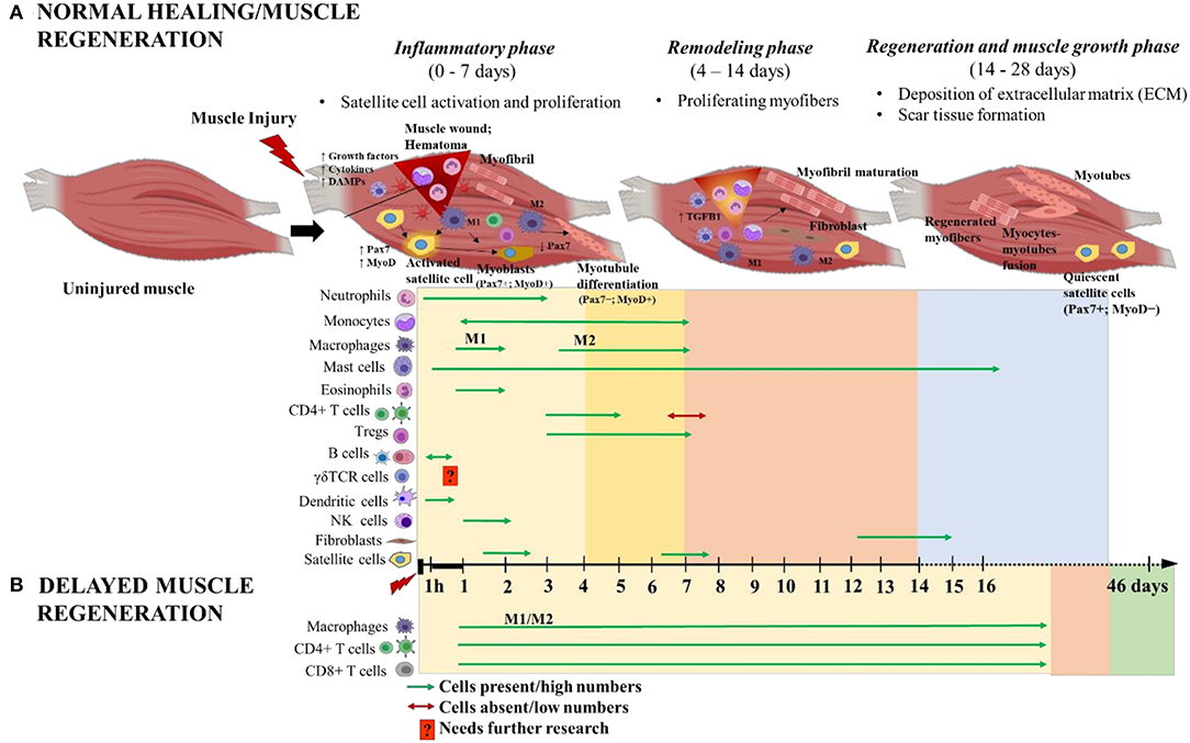 Frontiers | Time Course of Immune Response and Immunomodulation During ...