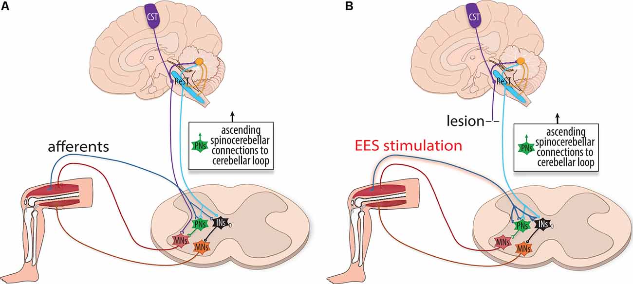 Electrical Stimulation for Spinal Cord Injury: How It Works