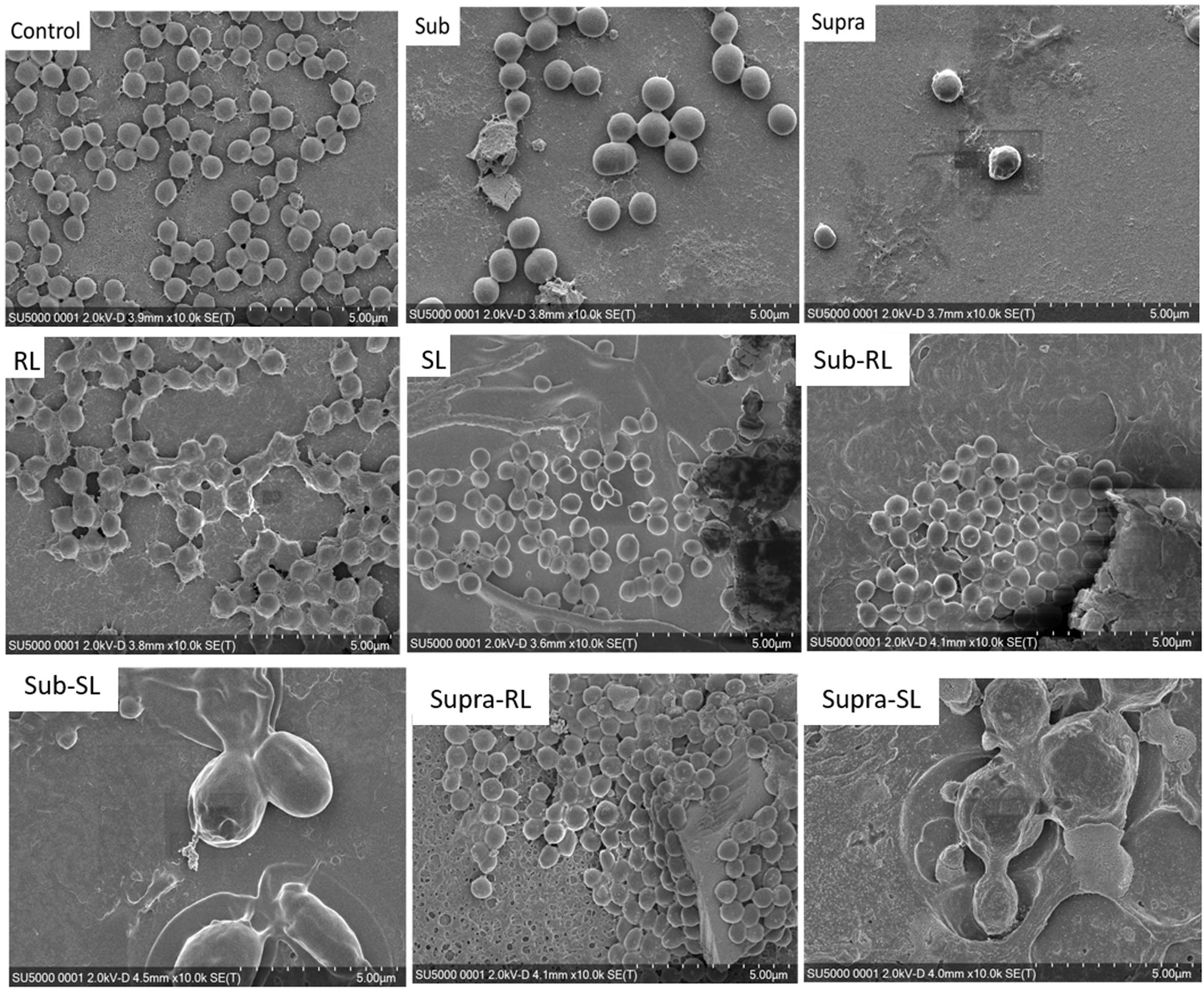 Staphylococcus aureus Bacteria, Scanning electron micrograp…