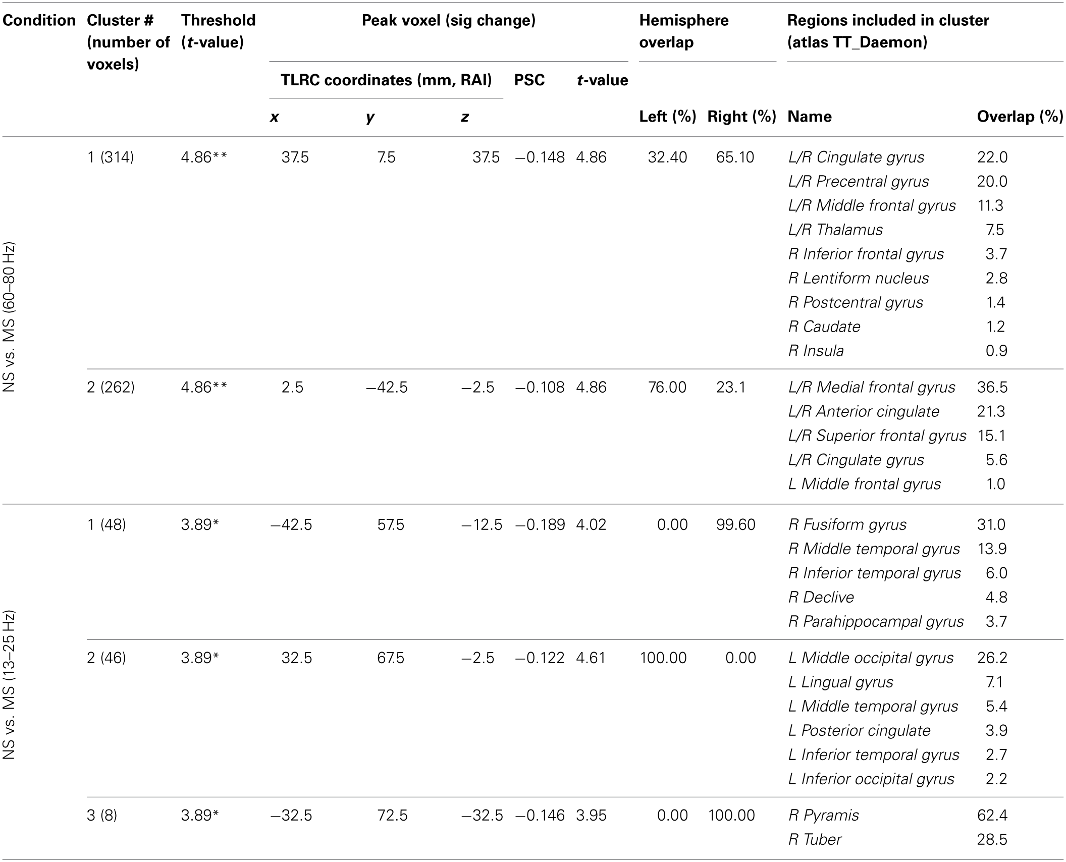 NS vs. MS beamforming solutions for gamma (60–80 Hz) and beta (13–25 Hz).