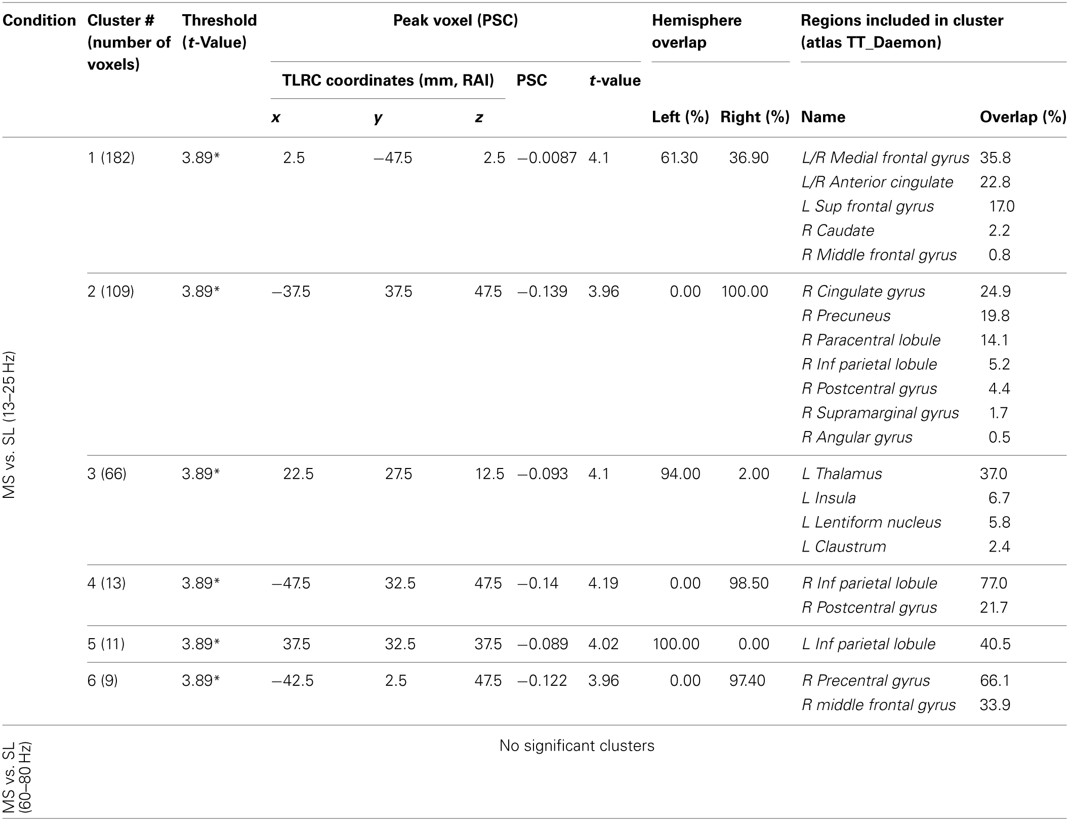 MS vs. SL beamforming solutions for gamma (60–80 Hz) and beta (13–25 Hz).