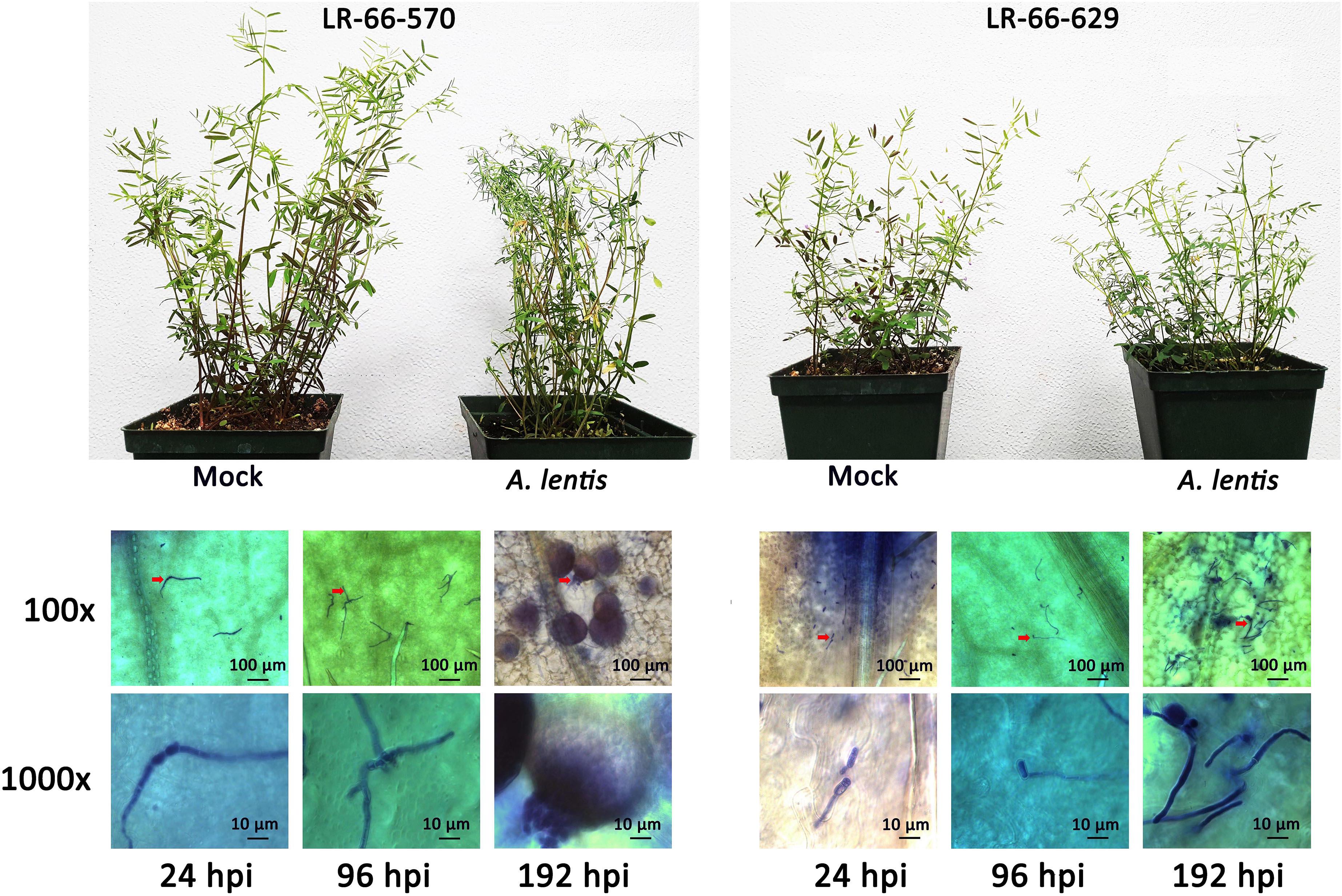 Frontiers | Interactive Gene Expression Patterns of Susceptible 