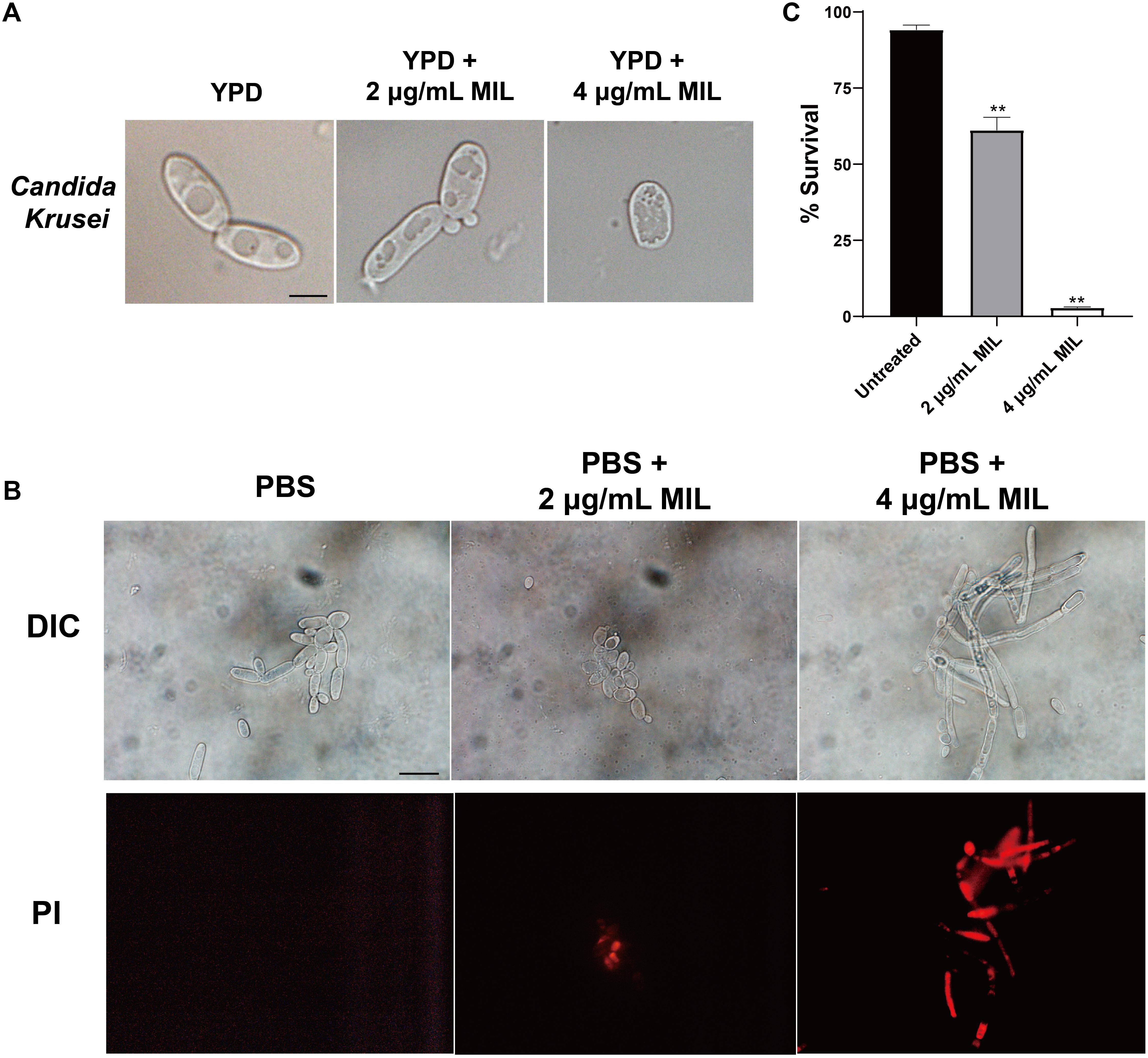 Frontiers Antifungal Activity and Mode of Action of Miltefosine