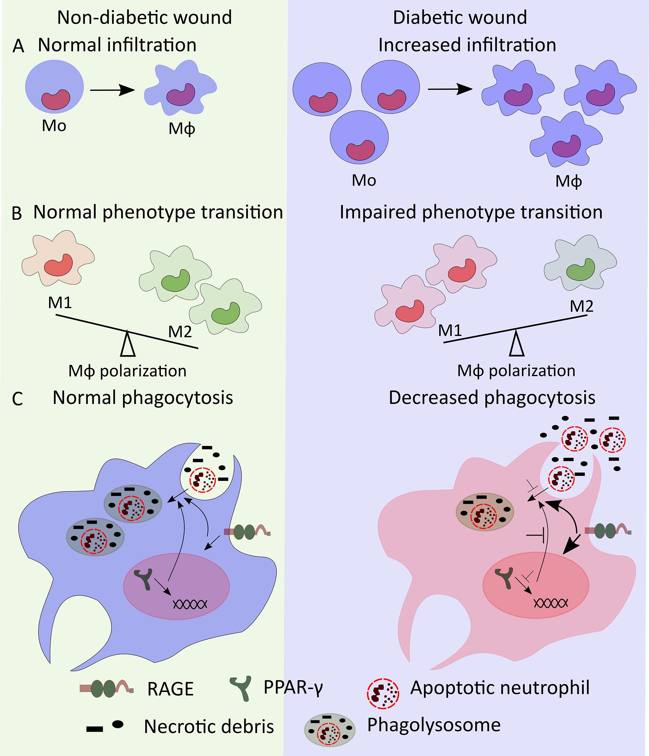 Frontiers  Exploring the contribution of pro-inflammatory cytokines to  impaired wound healing in diabetes