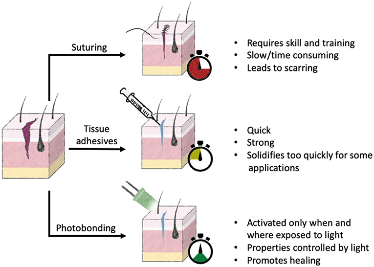 Wound Closure Techniques