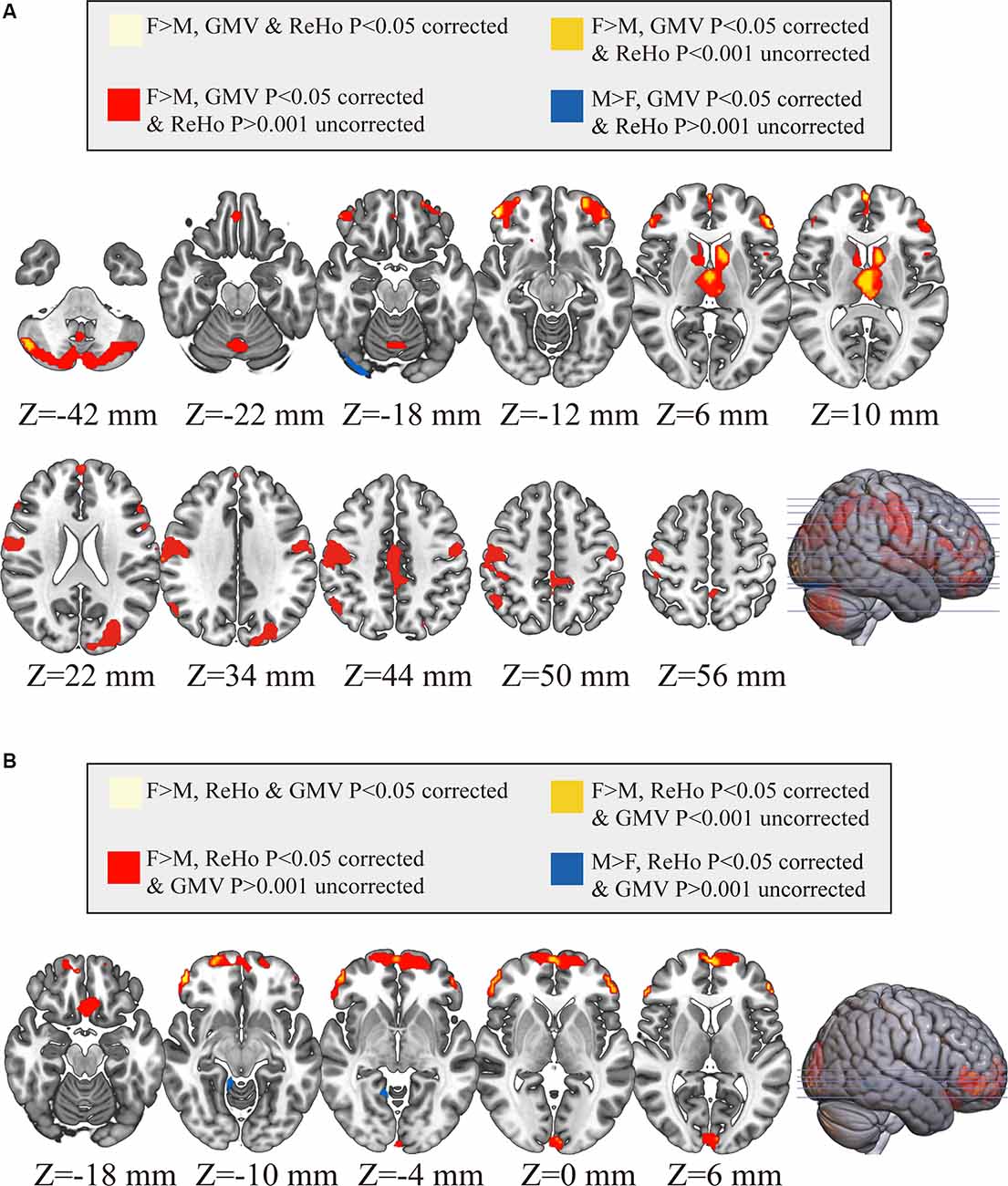 Frontiers Gender Differences Are Encoded Differently In The Structure And Function Of The