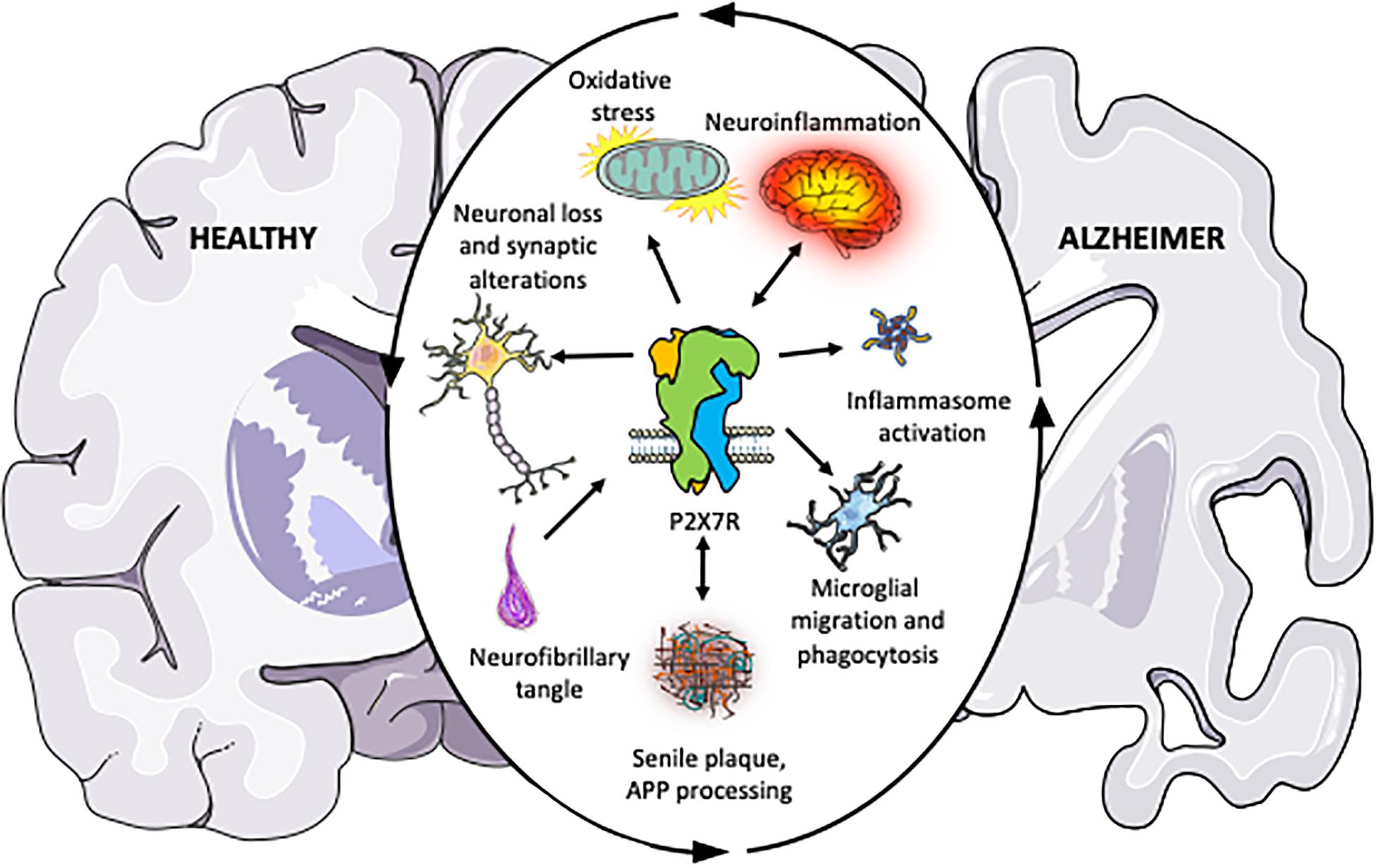 Frontiers | The Role of P2X7 Receptor in Alzheimer's Disease | Molecular  Neuroscience