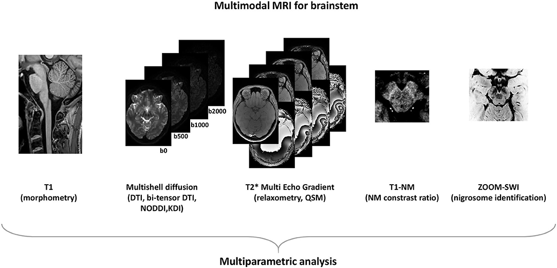 Frontiers | Modern Brainstem MRI Techniques for the Diagnosis of 