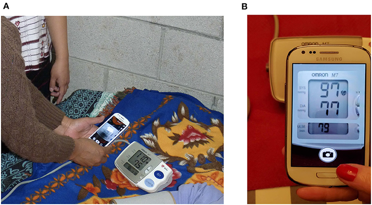 Wireless blood pressure monitor transmits reading to smartphone